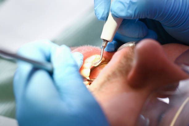 Best Urgent Care for Lost Fillings or Crowns in Covelo, CA
