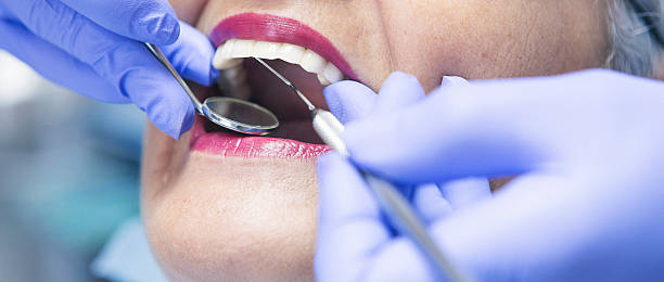 Best Emergency Dental Care for Broken or Chipped Teeth in Covelo, CA